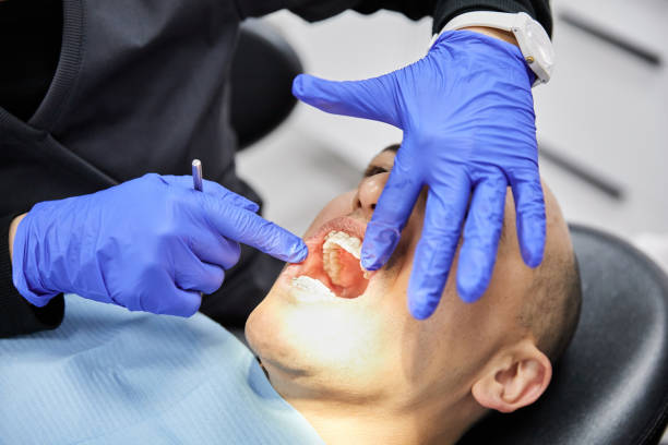 Best Emergency Dental Care for Broken or Chipped Teeth in Baidland, PA